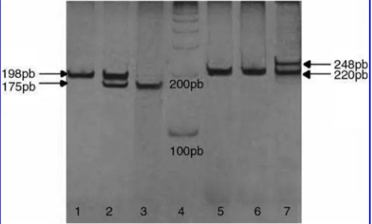 FIG. 1. MTHFR (1, 2, and 3) TSER (5, 6, and 7) genotyping by polymerase chain reaction visualized by electrophoresis in 7% polyacrylamide gel