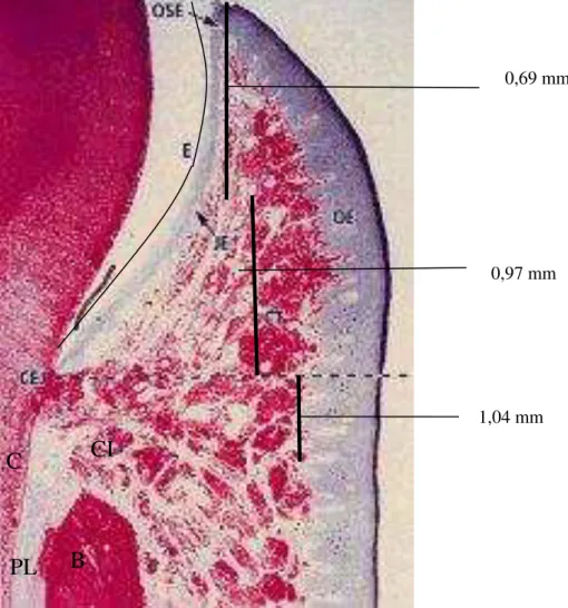 FIGURA  1  –  Representação  do  periodonto  e  suas  estruturas.  OE,  epitélio  oral; 