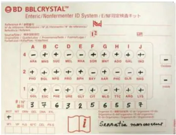 Figura  4.  Diagrama  do  sistema  BBL  Crystal  Enteric/Nonferment  com  representação numérica identificando um isolado como S