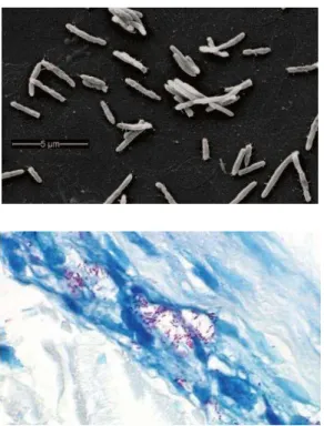 Figura 2. Morfologia do  Mycobacterium leprae.   