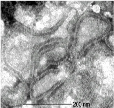 FIGURA 2 – Metapneumovírus humano à microscopia eletrônica (Fonte: VAN DEN  HOOGEN et al., 2001)