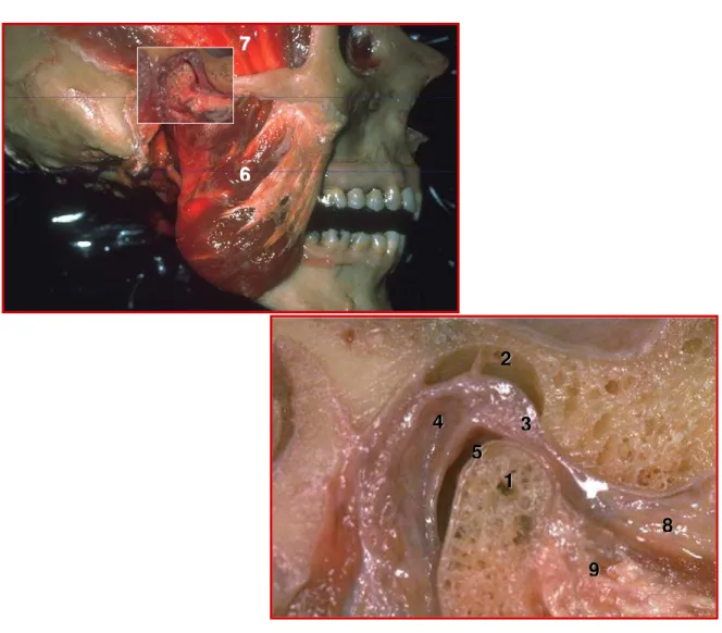 Figura 1.  Articulação temporomandibular e músculos mastigatórios.  1. côndilo  mandibular,  2