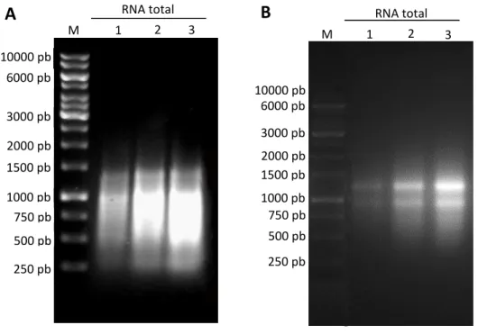 Figura  7  -  Eletroforese  em  gel  de  agarose  1,0  %  (m/v)  do  RNA  total  extraído  de  folhas de P