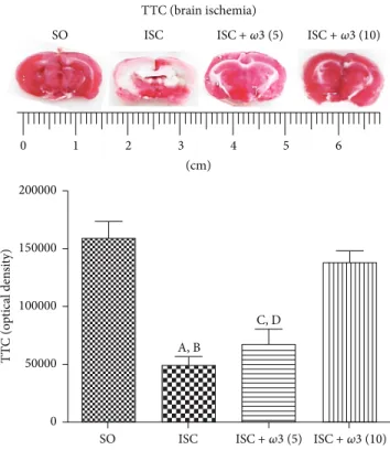 Figure 4: Efects of � 3 treatments in ischemic groups, visualized by the 2,3,5-triphenyltetrazolium chloride (TTC) staining as related to the SO group