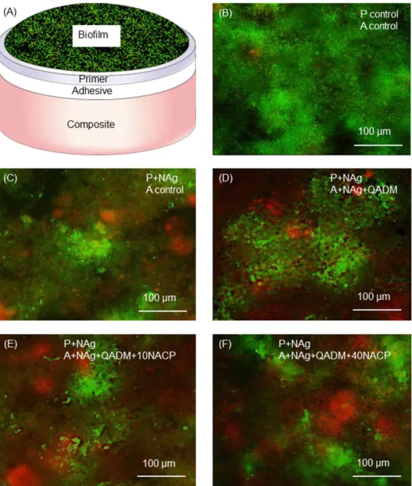 FIGURE 3. Human saliva microcosm biofilm live/dead staining assay. (A) Schematic of biofilm on cured disk with three layers: Primer, adhesive, and composite