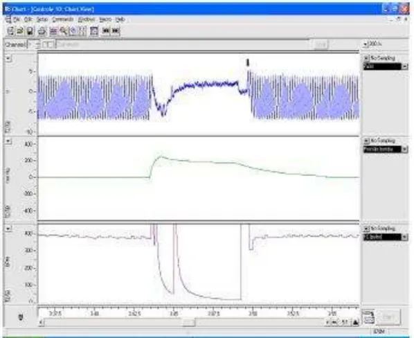 FIGURA 02- Representação da janela de visualização do software durante um  experimento  de  medida  indireta  de  pressão  arterial  sistólica