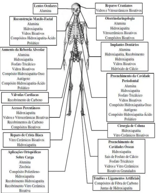 Figura  2.1  –  Aplicações  das  biocerâmicas  no  esqueleto  humano  (Hench  e  Wilson, 1993)