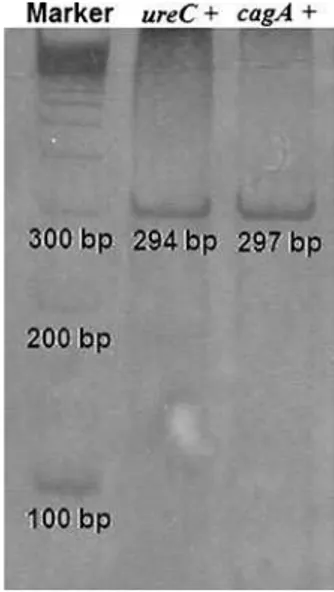 Fig. 3 Representative electro- electro-phoresis of the ureC and cagA genes amplification in 6%