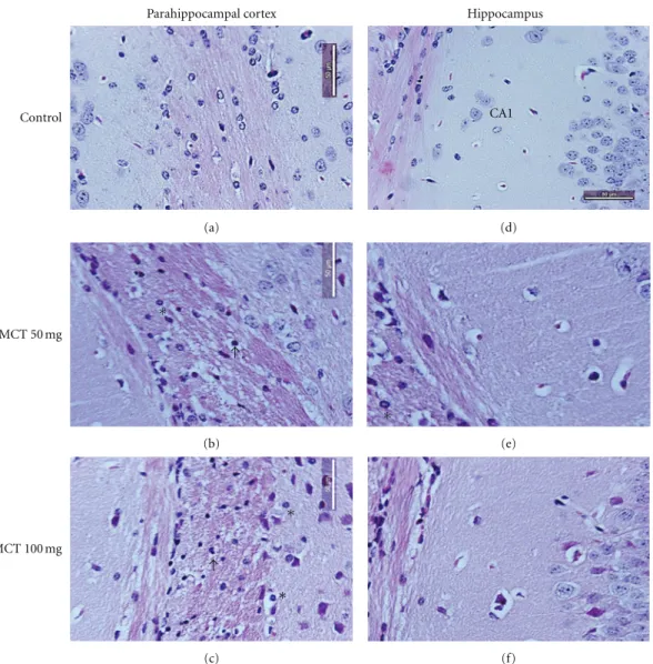 Figure 1: Histologic analysis of representative parahippocampal cortex and hippocampus sections
