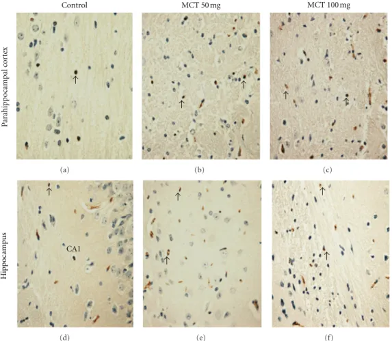 Figure 2: Representative examples of caspase-3 immunohistochemistry in the parahippocampal cortex and hippocampus of mice (400x).
