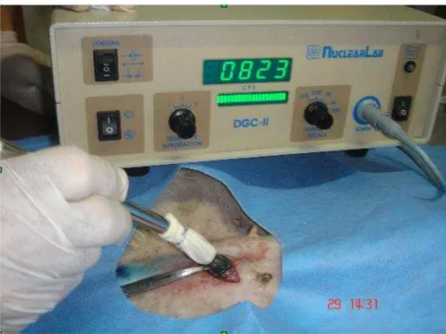 Figura 8 - Detecção de área captante em dissecção inguinal  