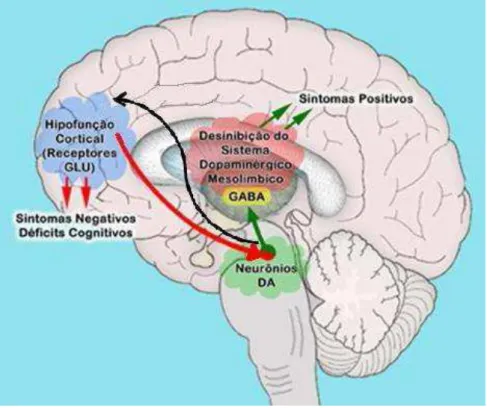 Fig. 2: Representação hipotética associando a hipofunção cortical (redução da atividade de receptores  NMDA) e os sintomas da esquizofrenia