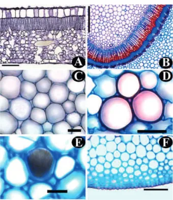 FIGURE 4 P. rigida .  A:  transversal  section  of  leaf  blade;  B-E:  transversal  sections  of  the  midrib  tissues;  B:  parenchyma  and  vascular  tissues;  C-E:  ground  parenchyma;  E:  raphids  bundle;    F:  epidermis  and  collenchyma