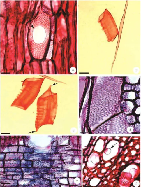 Figura 2 – Lenho de caule e raiz de Aegiphila sellowiana Cham. a. Secção longitudinal radial do lenho de raiz, mostrando placa de perfuração  simples  em  vaso  (seta)