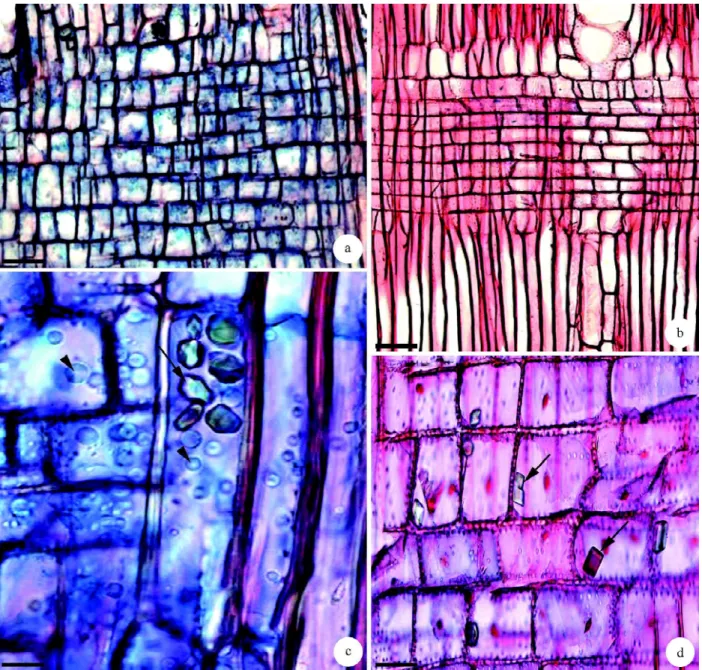 Figura 4 – Secções longitudinais radiais do  lenho de caule e raiz de Aegiphila sellowiana Cham