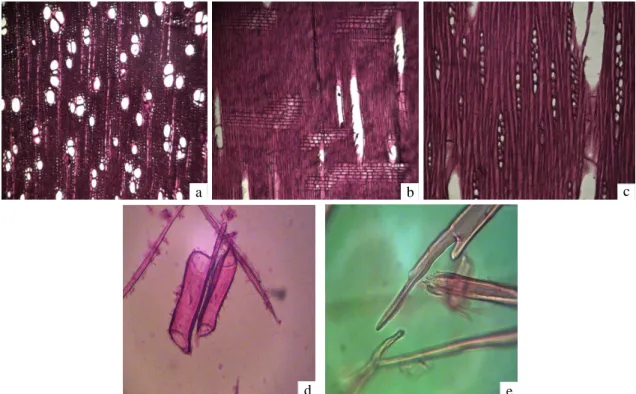 Figura 1 – Cortes histológicos da madeira de candeia (Eremanthus erythropappus (DC.) Macleish)