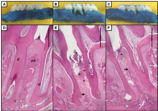 Figure  2.  Aspects  Macroscopic  (A-F;  4  x  magnification)  and  of  histopathology  of  region  between  the  first  and  second  molars  of  rats  (G-I;  40  x  magnification)  of  normal  periodontium  (A  and  D)  or  periodontium  of  animals  subm