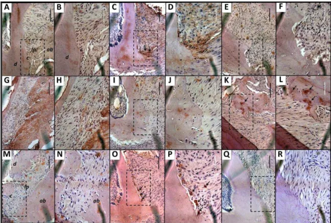 Figure 3.  Immunohistochemical analysis for RANKL (A, B,  C, D, E and F), OPG (G, H, I, J, K and L) and TRAP  (M, N, O, P, Q and R) of apical region between 1° and 2° molars of normal periodontium (A-B, G-H and M-N) or  periodontium of animals submitted to
