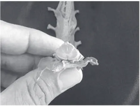 Figura 2 - Detalhe de uma peça anatômica da medula espinhal, em relação aos dedos de uma  mão, onde percebemos seu diminuto tamanho, apesar de receber aferências de todo o corpo