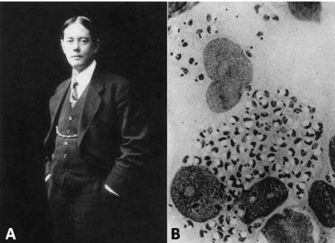 Figura 2.11: A - James Holmer Wright (1869-1928); B – Foto de imprint de úlcera cutânea do artigo original de  Wright (1903) em que observa-se um grande número de fo rmas amastigotas