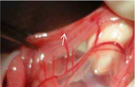 Figura  3a - Arcada do colo irrigado ramo da artéria mesentérica inferior (seta) 