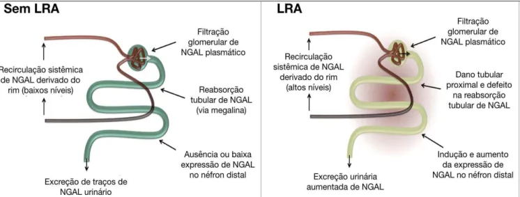 Figura 4. Percurso e expressão do NGAL ao longo do néfron no rim saudável e  durante a lesão renal aguda (LRA)