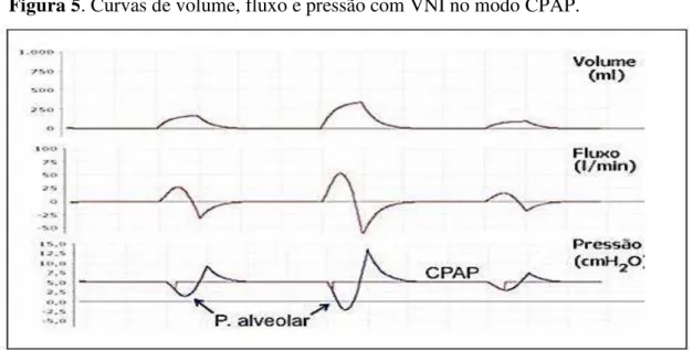 Figura 5. Curvas de volume, fluxo e pressão com VNI no modo CPAP. 
