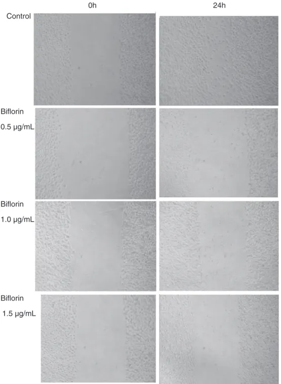 Fig. 6. Photographs of wounds in monolayers of cells. Cell layers were wounded 2 days after seeding