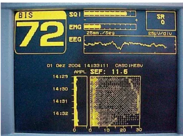 Figura 6 - Visão global dos parâmetros derivados do  EEG. 