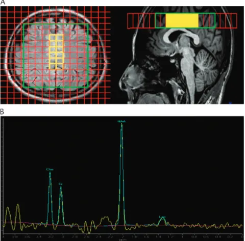 FIGURE 1. A, Axial and sagittal view of the 2D matrix acquired by the MRSI sequence. The green line indicates the region selected for magnetic field homogenization purposes