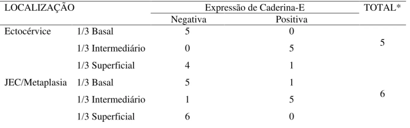 Tabela 3  –  Imunoexpressão da Caderina-E em Cervicites por região histológica e na espessura epitelial 