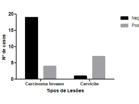Figura 10 - Imunoexpressão de Caderina-E no Carcinoma Invasor do colo uterino e na Cervicite 