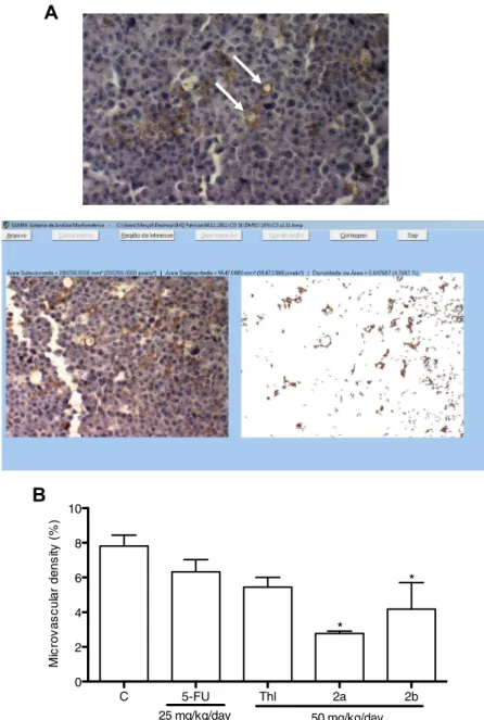 Fig. 5. Effects on tumor angiogenesis evaluated by immunohistochemistry. (A) Images of a hot spot on the tumor obtained by inverted microscope and processed by the System Quantification of Angiogenesis (SQAN)