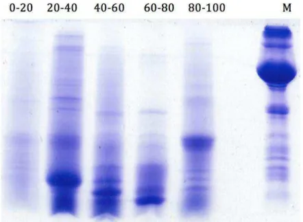 Figura 6  –  Eletroforese em gel de poliacrilamida 12,5% das frações protéicas.  