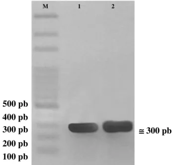 Figura 6. Eletroforese em gel de agarose 1%, mostrando fragmento de 302 pb específico  para  B