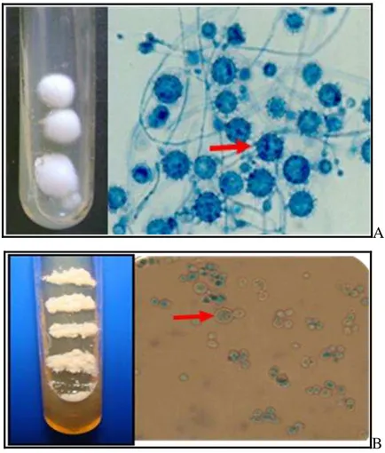 Figura  4  -  Histoplasma  capsulatum :  A  -  aspecto  macromorfológico  em  ágar  batata  dextrose,  demonstrando  colônia  algodonosa  branca;  aspecto  micromorfológico  em  lactofenol  azul  de  algodão,  mostrando  os  macroconídios  tuberculados  (e