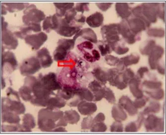 Figura 2 - Aspecto microscópico de  H.  capsulatum  corado ao Giemsa a partir de creme  leucocitário