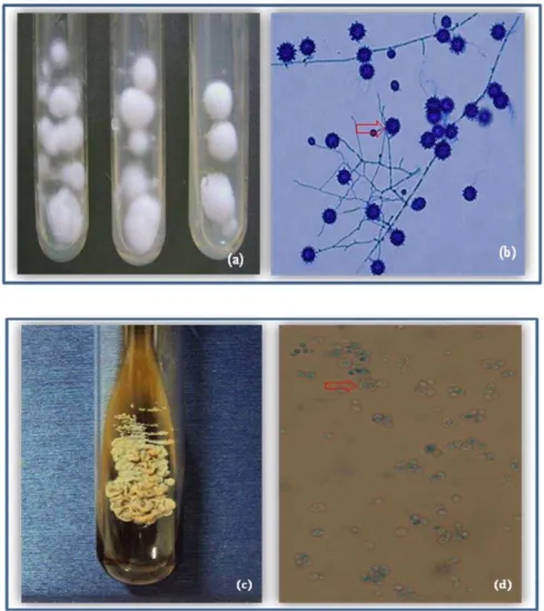 Figura  3  -  Histoplasma  capsulatum :  a)  aspecto  macromorfológico  em  ágar  batata  dextrose,  demonstrando  colônia  algodonosa  branca;  b)  aspecto  micromorfológico  em  lactofenol azul de algodão, mostrando os macroconídios tuberculados (estalag