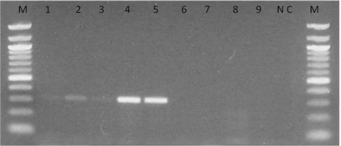 Figura  1.  Gel  electrophoresis  in  1%  agarose  representative,  showing  fragments  of  approximately  300  bp  gene,  specific  for  Ryp1   gene  of  Histoplasma  capsulatum 