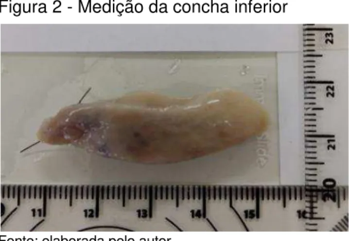 Figura 2 - Medição da concha inferior 