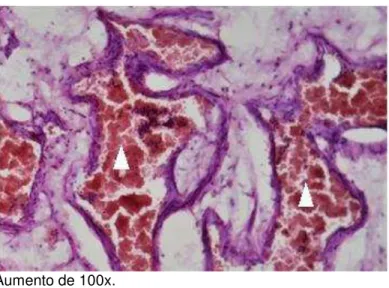 Figura 11 - Sinusóides venosos (cabeças de setas brancas) na lâmina própria da  concha nasal inferior 