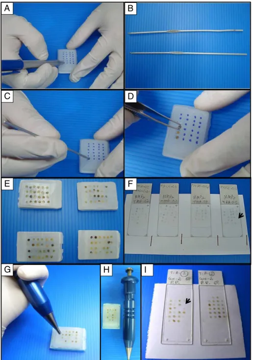 Fig. 1. Adapted tissue microarray method. The alternative method is shown in Fig. 1A – F