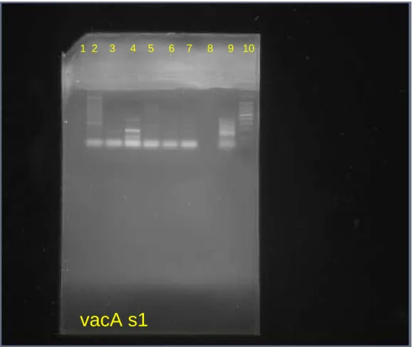 Figura 5: Gel de agarose para visualização das bandas do alelo s1 do gene vacA 