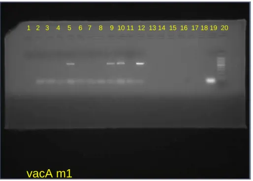 Figura 6: Gel de agarose para visualização das bandas do alelo m1 do gene vacA 