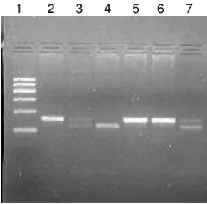 Figura 1. Gel de agarose com os genótipos  hom A  e  homB  de 6 pacientes.  