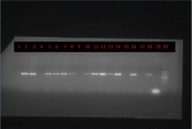Figura 9: Gel de Agarose para visualização das  bandas do alelo  m 1 do gene vacA. 