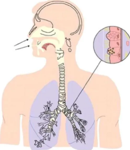 Fig. 04  - Radônio como causa de Câncer de pulmão (EPA)