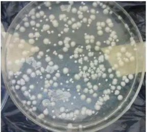 Figura  02  –   Cultura  de  Candida   spp.  obtida  a  partir  da  amostra  de  tecidos  profundos  de  pacientes  diabéticos com úlceras nos pés inoculada no meio ágar Sabouraud com cloranfenicol