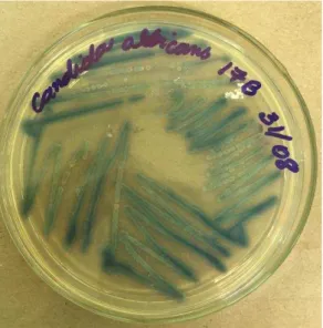 Figura  05  –   Inoculação  das  amostras  do  estudo  no  meio  ágar  HiCrome  Candida   diferencial®