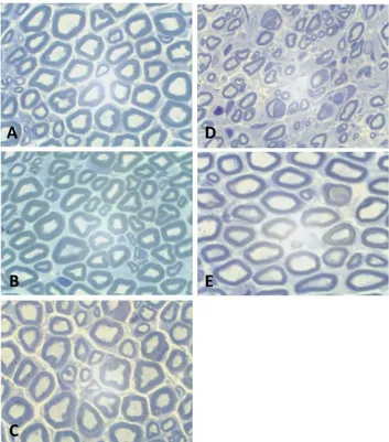 Tabela 3. Média e desvio-padrão das áreas das bainhas de mielina  (  µm²) e média e desvio-padrão das espessuras das bainhas de  mielina (  µm) Área da bainha  de mielina Espessura da bainha de mielina Média DP Média DP GC 43,07 a 1,80 3,82 a 0,33 GCC 7,72